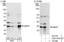 Detection of human UBE2T by western blot and immunoprecipitation.