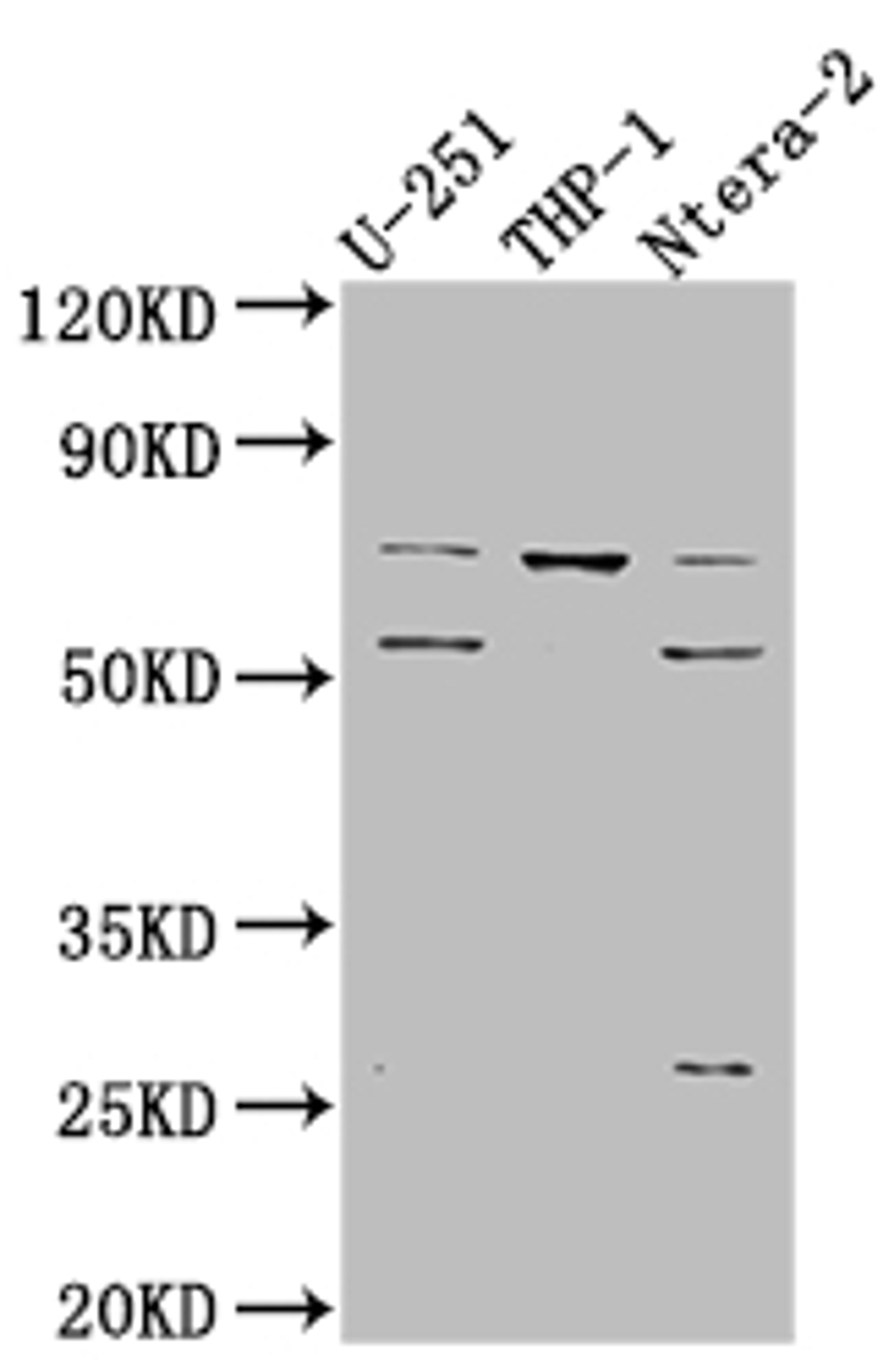Western Blot. Positive WB detected in: U-251 whole cell lysate, THP-1 whole cell lysate, Ntera-2 whole cell lysate. All lanes: PTH1R antibody at 1:1000. Secondary. Goat polyclonal to rabbit IgG at 1/50000 dilution. Predicted band size: 67 kDa. Observed band size: 72, 55 kDa. 