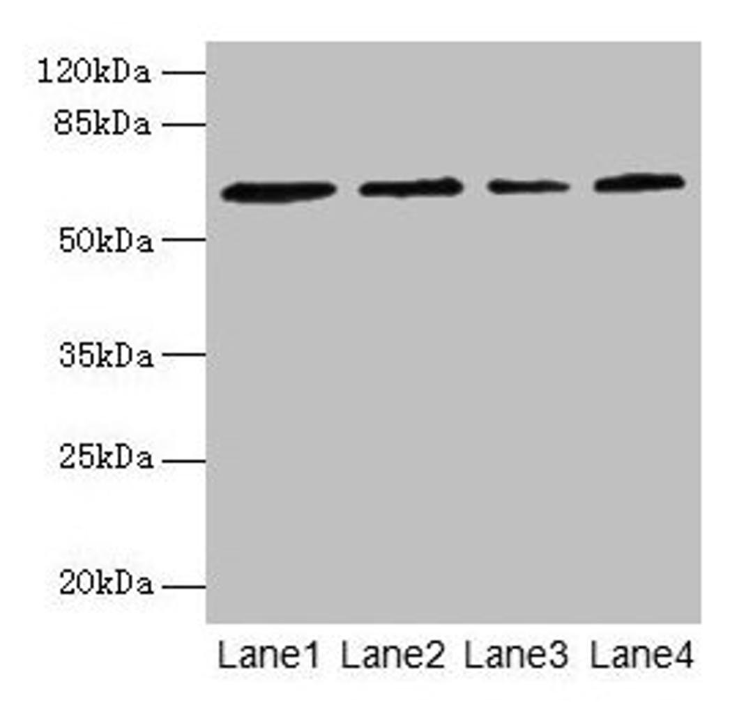 Western blot. All lanes: CSGALNACT2 antibody at 4µg/ml. Lane 1: K562 whole cell lysate. Lane 2: 293T whole cell lysate. Lane 3: Jurkat whole cell lysate. Lane 4: PC-3 whole cell lysate. Secondary. Goat polyclonal to rabbit IgG at 1/10000 dilution. Predicted band size: 63, 39 kDa. Observed band size: 63 kDa