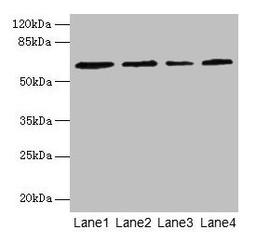 Western blot. All lanes: CSGALNACT2 antibody at 4µg/ml. Lane 1: K562 whole cell lysate. Lane 2: 293T whole cell lysate. Lane 3: Jurkat whole cell lysate. Lane 4: PC-3 whole cell lysate. Secondary. Goat polyclonal to rabbit IgG at 1/10000 dilution. Predicted band size: 63, 39 kDa. Observed band size: 63 kDa