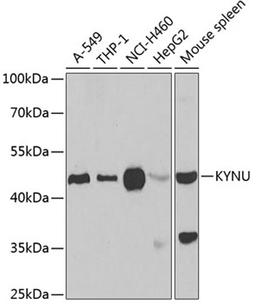 Western blot - KYNU antibody (A6643)