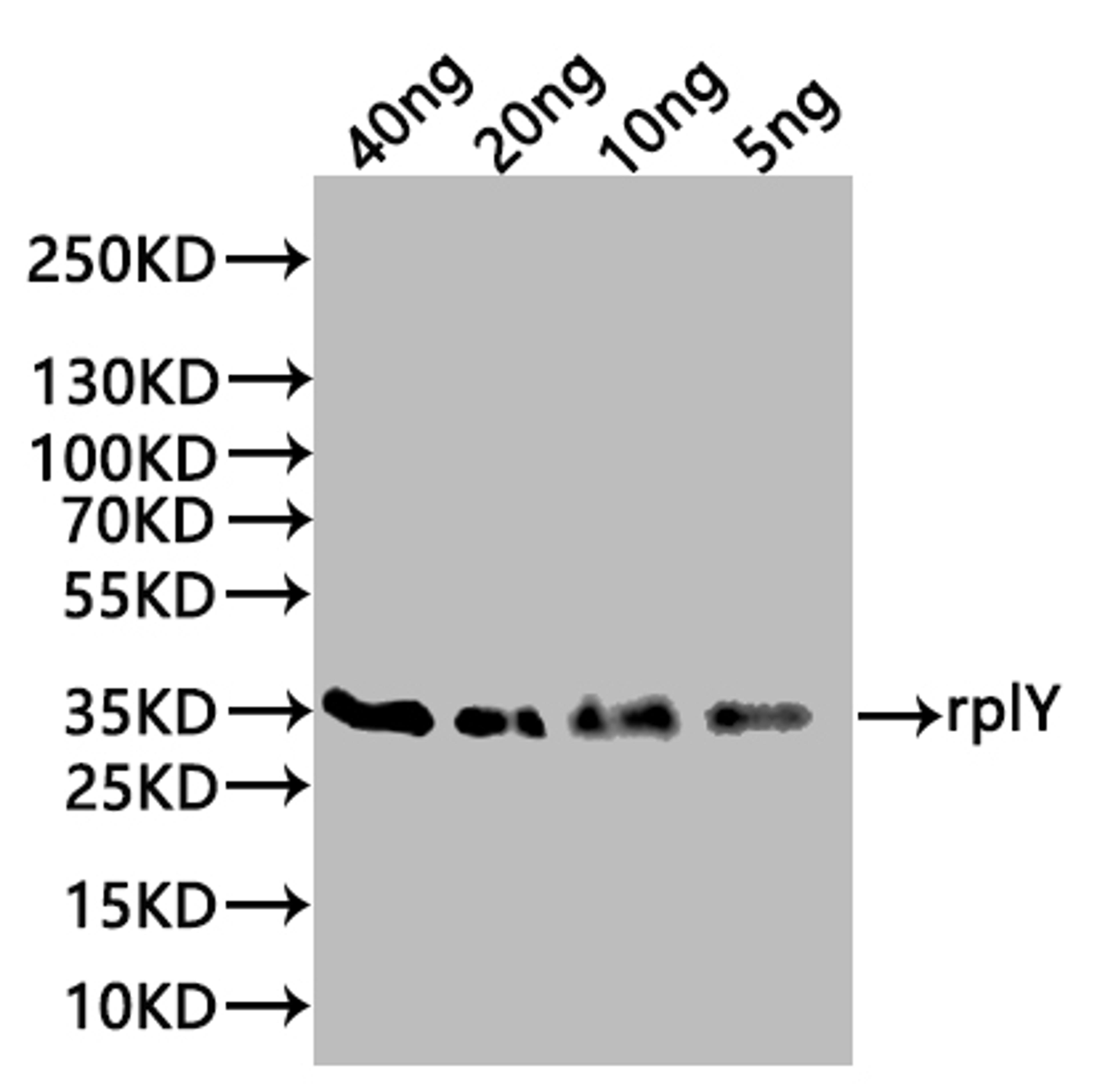 Western Blot. Positive WB detected in: recombinant protein. All lanes:rplY Antibody at 1:1000. Secondary. Goat polyclonal to rabbit IgG at 1/20000 dilution. Predicted band size: 35 kDa. Observed band size: 35 kDa. 
