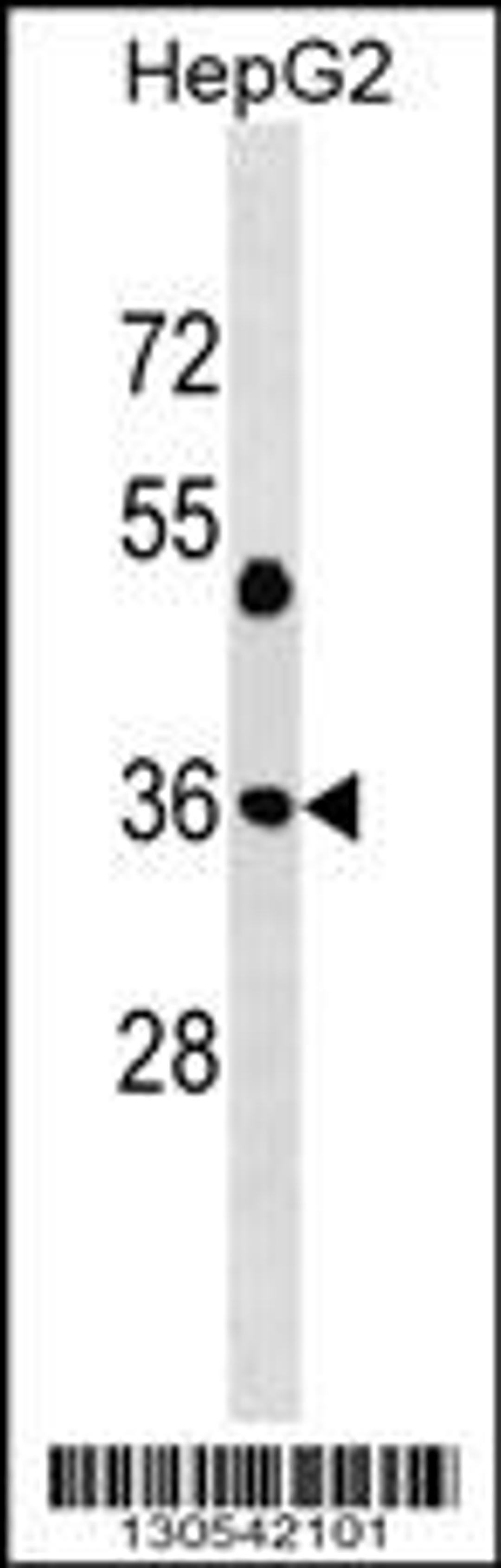 Western blot analysis in HepG2 cell line lysates (35ug/lane).