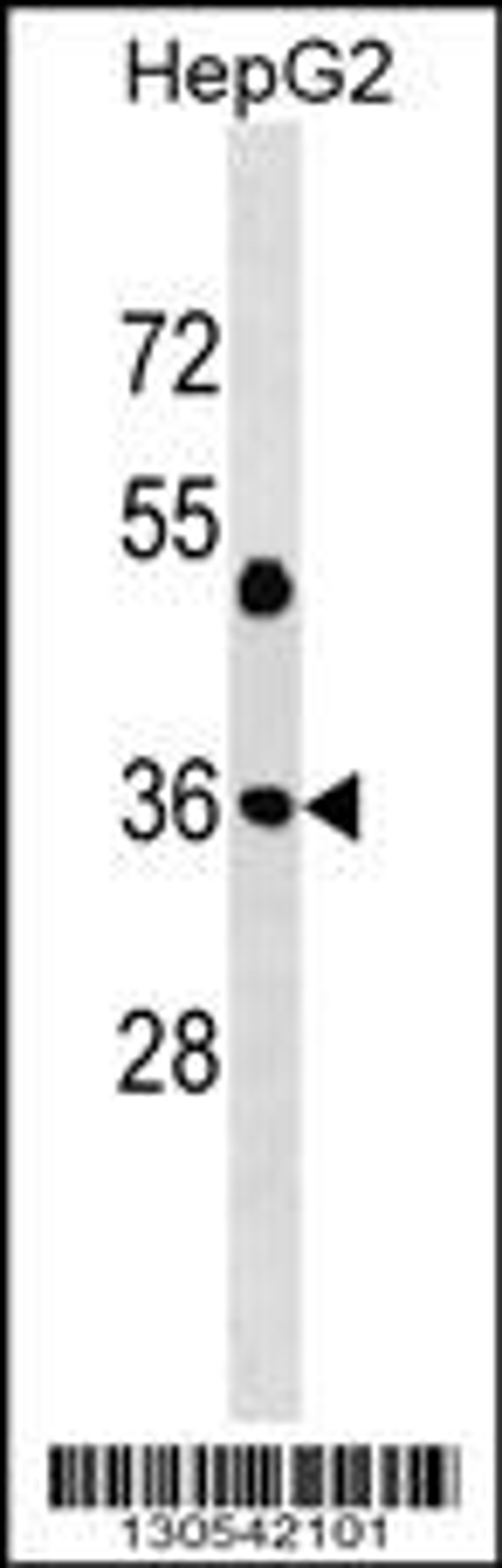 Western blot analysis in HepG2 cell line lysates (35ug/lane).