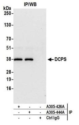 Detection of human DCPS by western blot of immunoprecipitates.