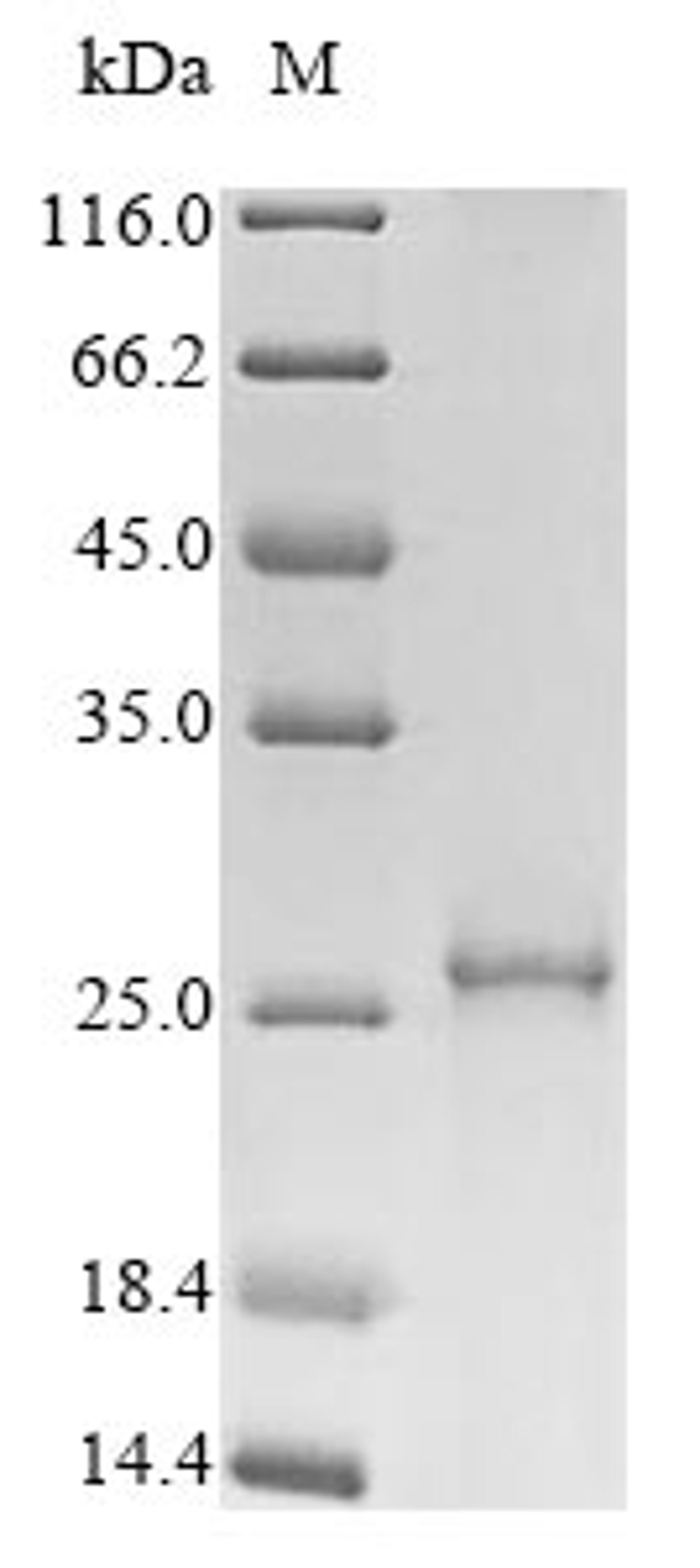 (Tris-Glycine gel) Discontinuous SDS-PAGE (reduced) with 5% enrichment gel and 15% separation gel.