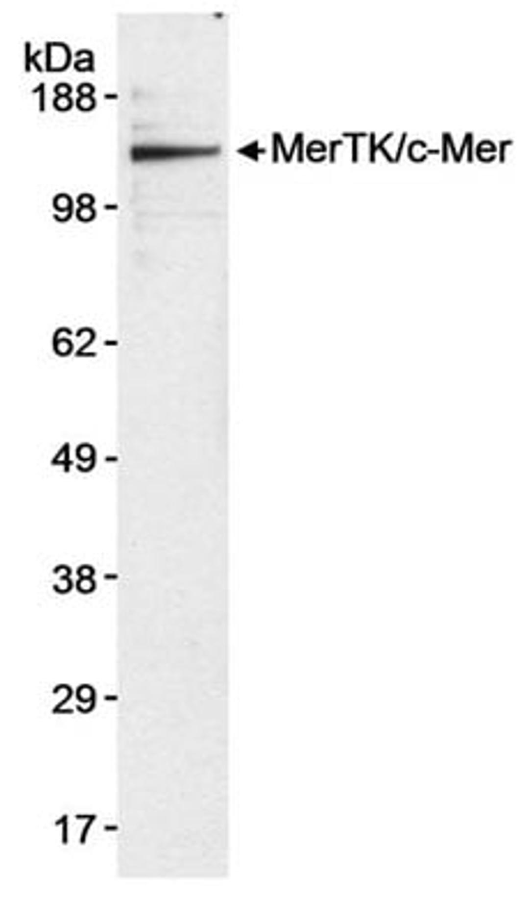 Detection of human MerTK/c-Mer by western blot.