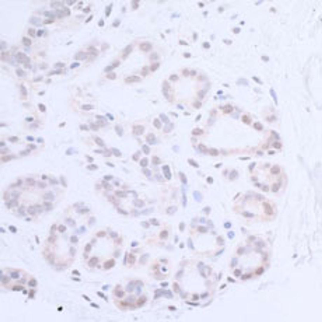 Detection of human XPA by immunohistochemistry.