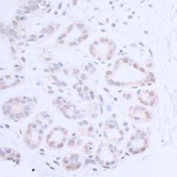 Detection of human XPA by immunohistochemistry.