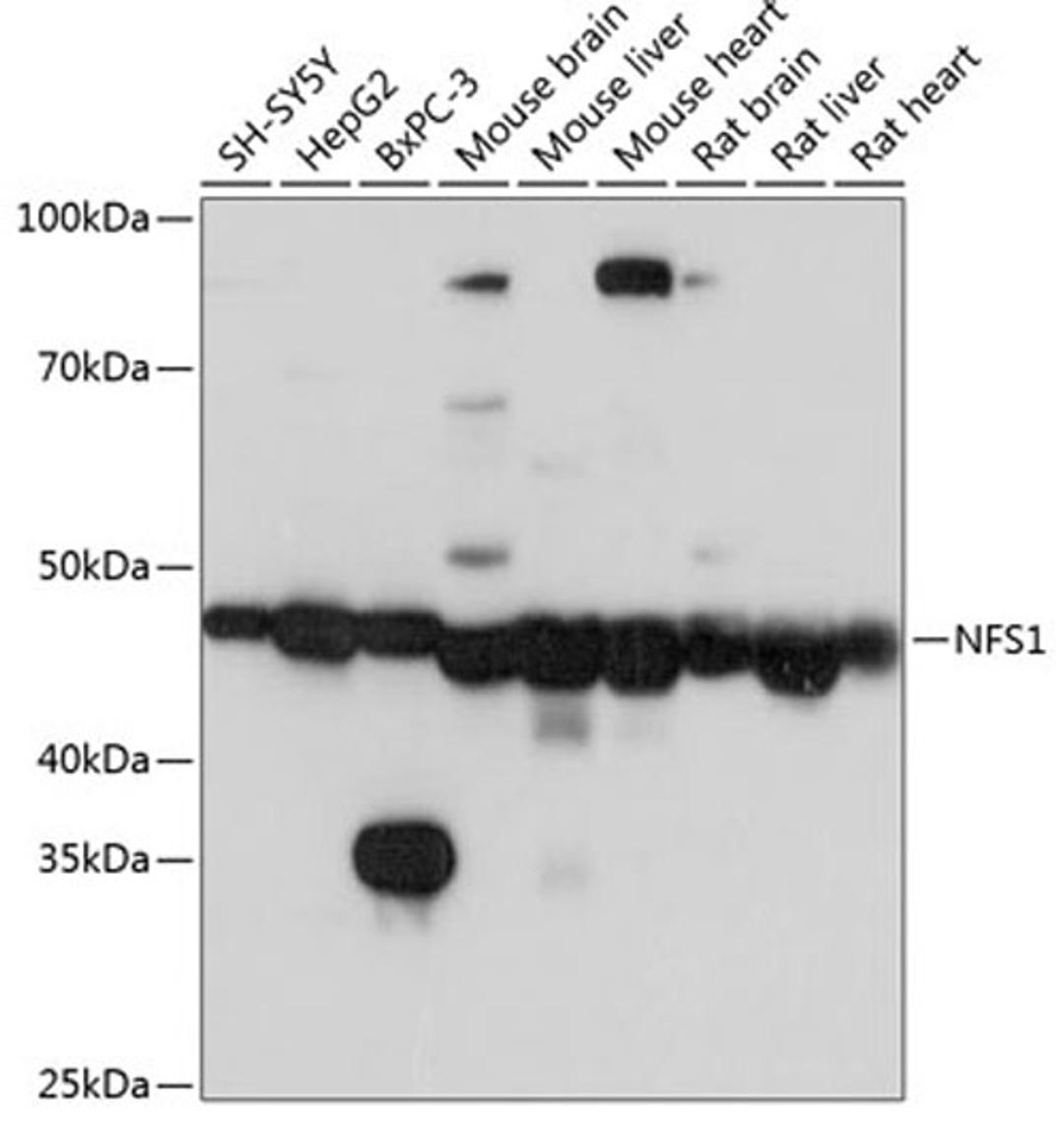 Western blot - NFS1 Polyclonal Antibody (A6668)