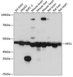 Western blot - NFS1 Polyclonal Antibody (A6668)