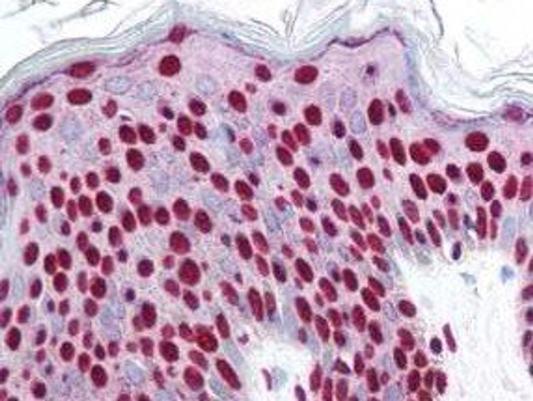 Immunohistochemical staining of variety of tissues including multi-human, multi-brain and multi-cancer slides using SMAD3 (phospho-S423) antibody