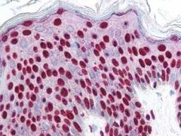 Immunohistochemical staining of variety of tissues including multi-human, multi-brain and multi-cancer slides using SMAD3 (phospho-S423) antibody