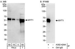 Detection of human MYT1 by western blot and immunoprecipitation.