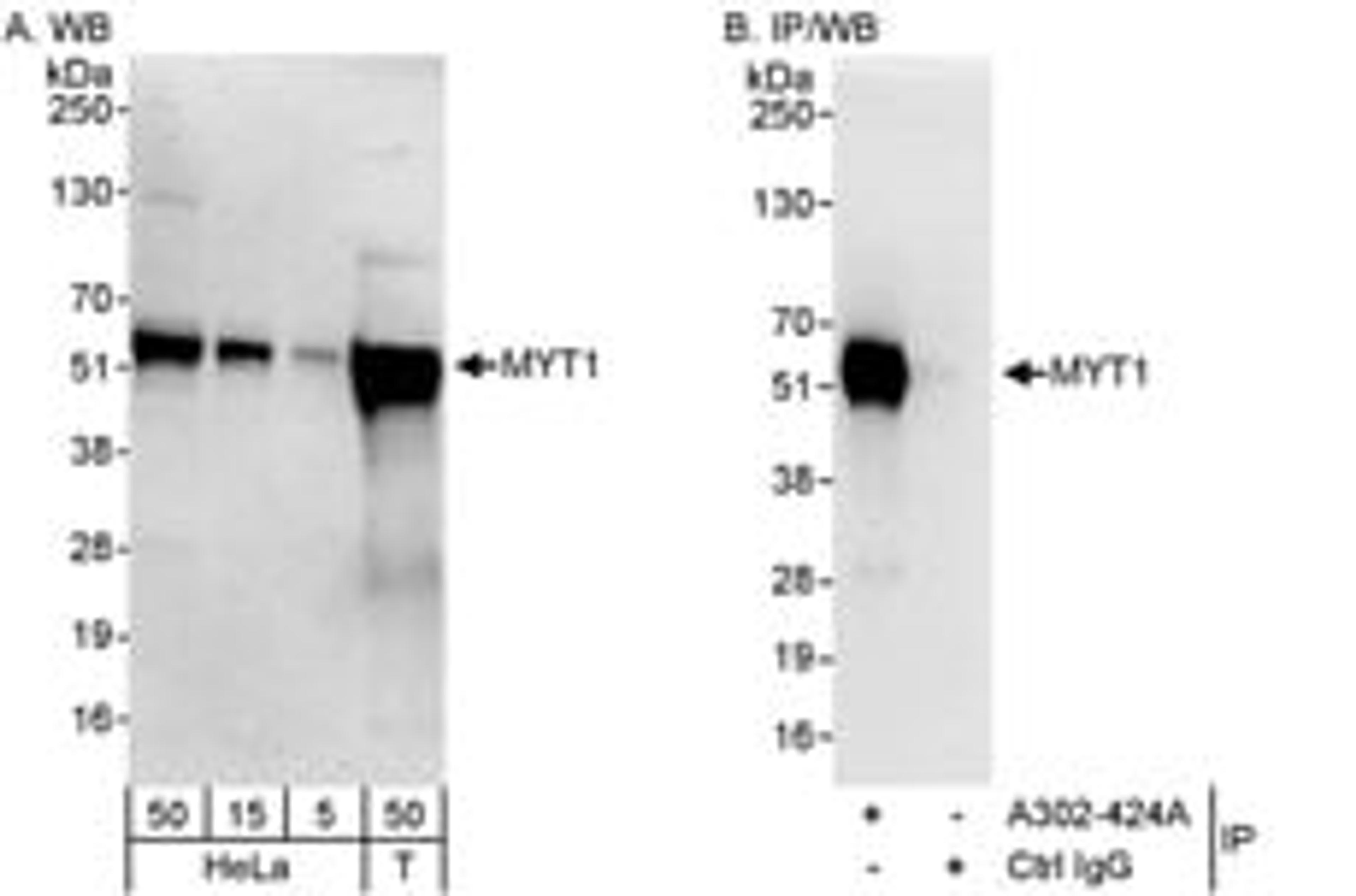 Detection of human MYT1 by western blot and immunoprecipitation.