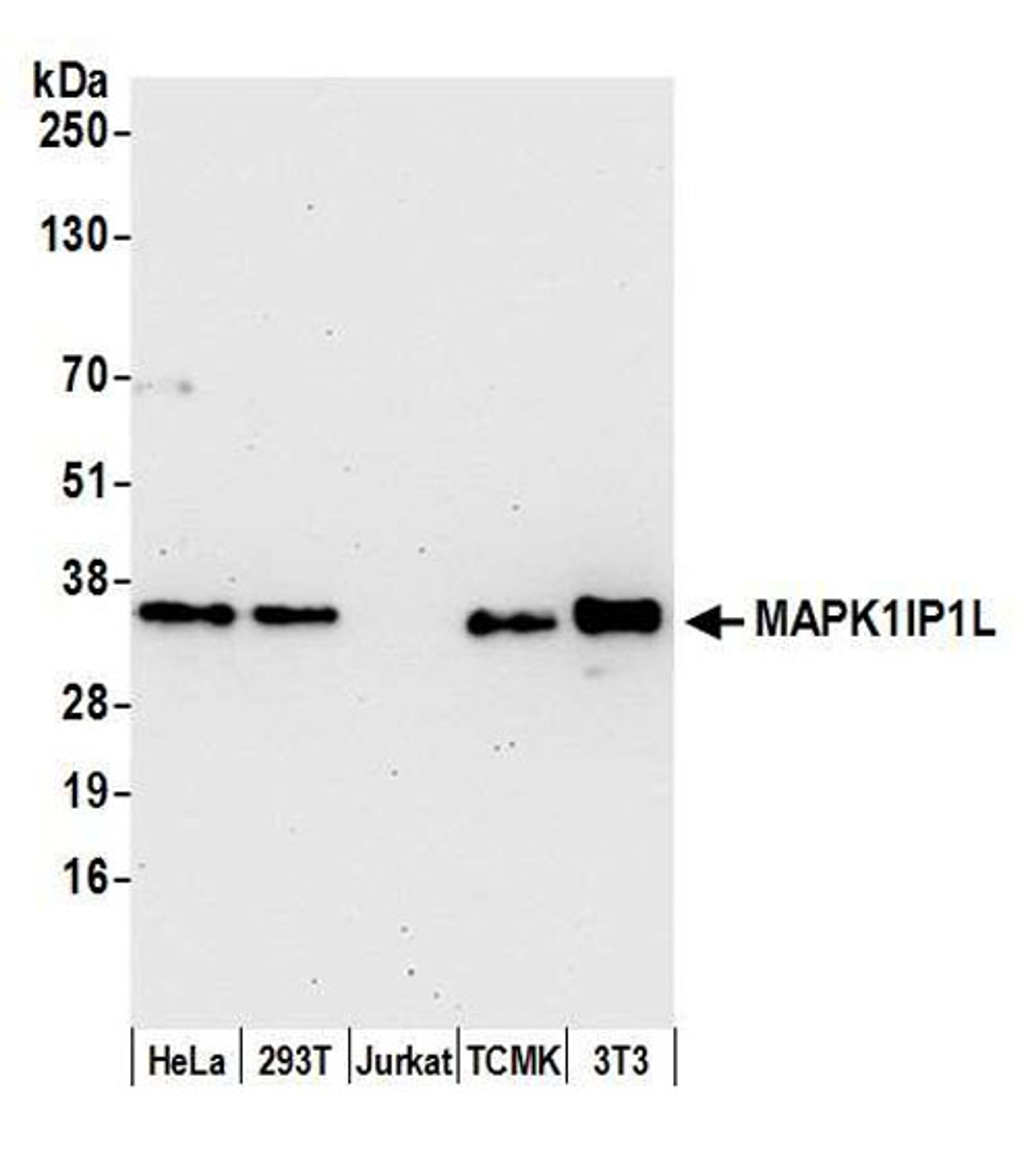 Detection of human and mouse MAPK1IP1L by WB.