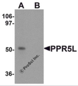 Western blot analysis of PRR5L in 3T3 cell lysate with PRR5L antibody at 1 &#956;g/mL in (A) the absence and (B) the presence of blocking peptide