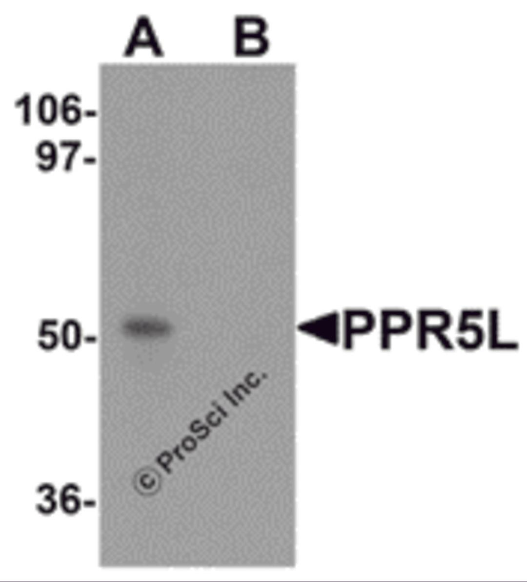 Western blot analysis of PRR5L in 3T3 cell lysate with PRR5L antibody at 1 μg/mL in (A) the absence and (B) the presence of blocking peptide