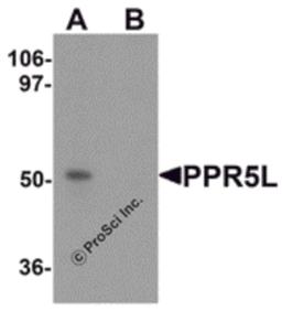 Western blot analysis of PRR5L in 3T3 cell lysate with PRR5L antibody at 1 μg/mL in (A) the absence and (B) the presence of blocking peptide