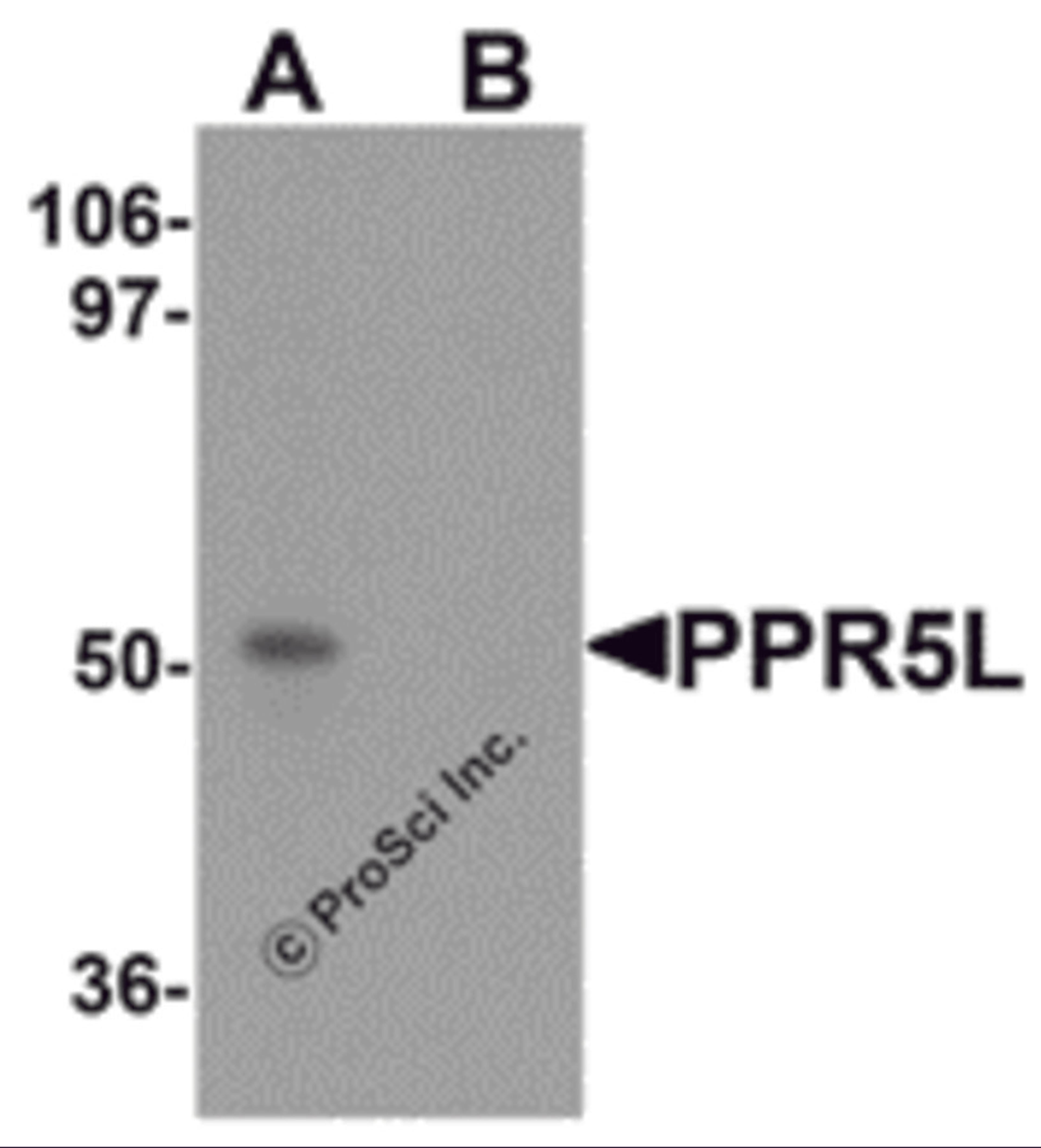 Western blot analysis of PRR5L in 3T3 cell lysate with PRR5L antibody at 1 μg/mL in (A) the absence and (B) the presence of blocking peptide