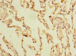 Immunohistochemistry of paraffin-embedded human lung tissue using CSB-PA761358LA01HU at dilution of 1:100