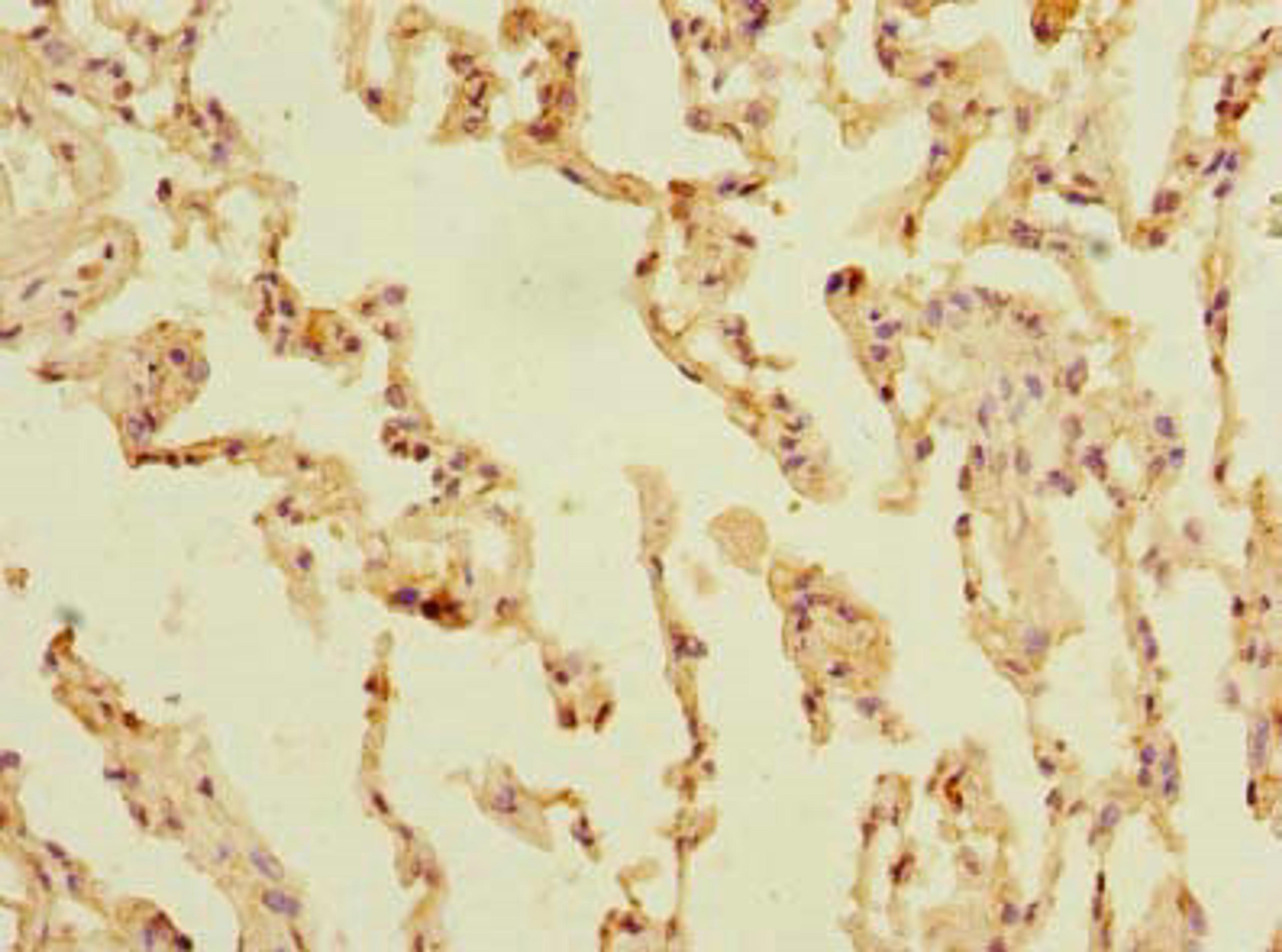 Immunohistochemistry of paraffin-embedded human lung tissue using CSB-PA761358LA01HU at dilution of 1:100