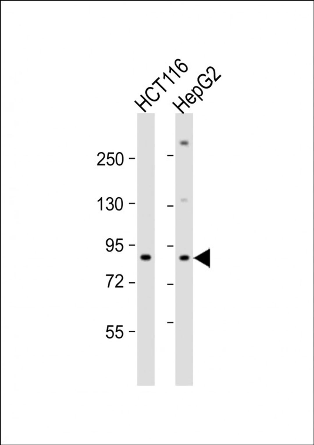 Western Blot at 1:1000 dilution Lane 1: HCT116 whole cell lysate Lane 2: HepG2 whole cell lysate Lysates/proteins at 20 ug per lane.