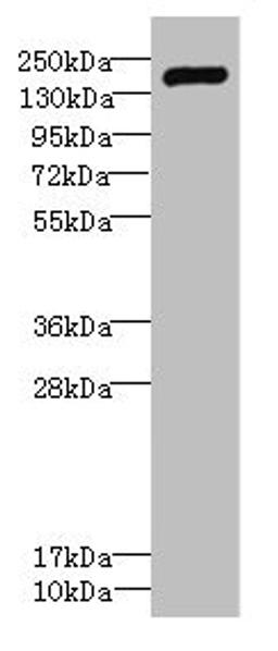 Western blot. All lanes: VARS antibody IgG at 2.29ug/ml + Hela whole cell lysate. Secondary. Goat polyclonal to rabbit IgG at 1/10000 dilution. Predicted band size: 141, 34 kDa. Observed band size: 141 kDa. 