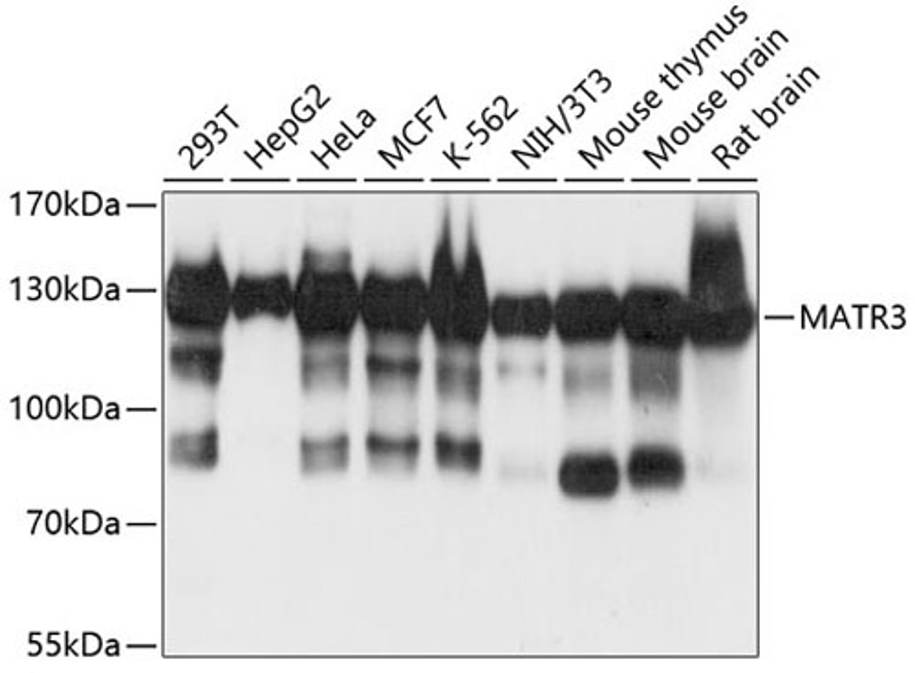 Western blot - MATR3 antibody (A5905)