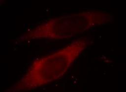 Immunocytochemistry/Immunofluorescence: Inhibin beta A Antibody [NB110-61019] - Analysis of Hela cells.