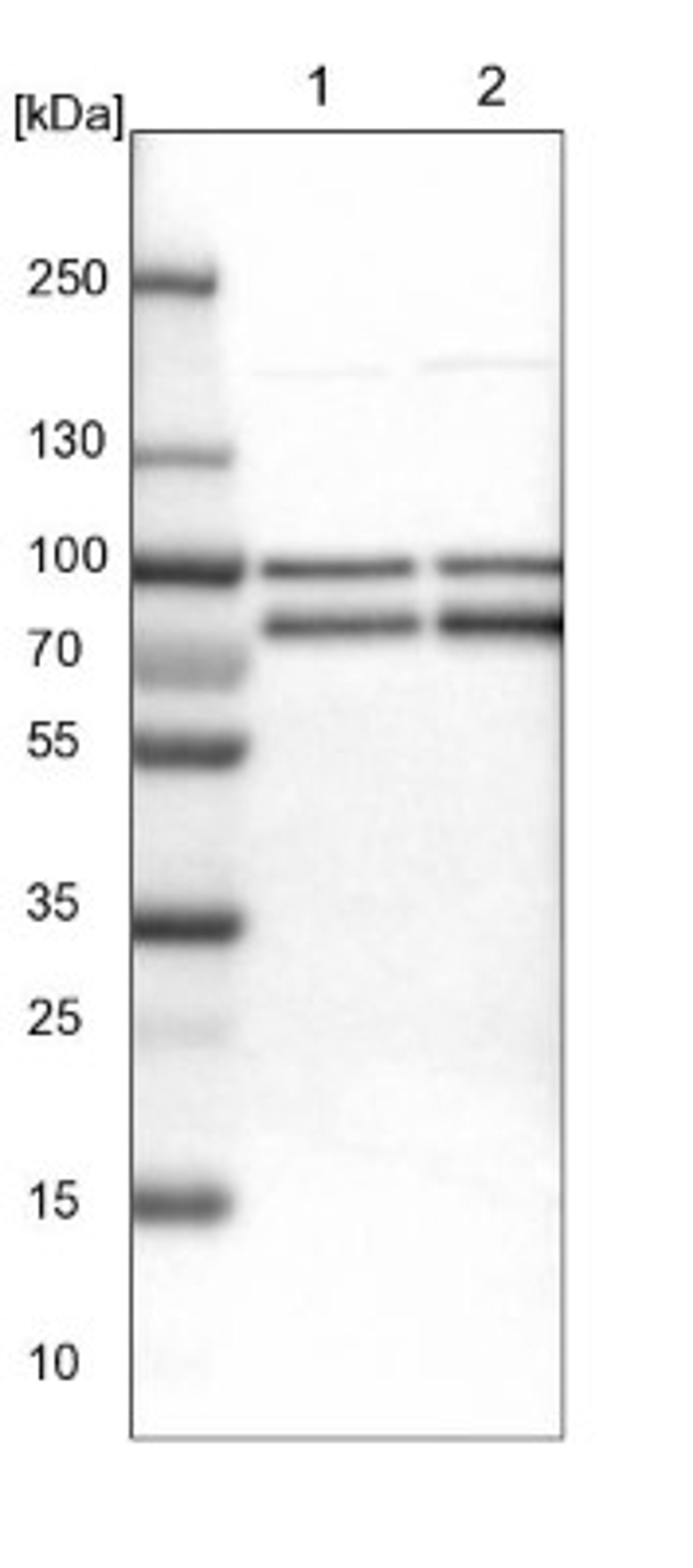 Western Blot: FUBP1 Antibody [NBP1-83918] - Lane 1: NIH-3T3 cell lysate (Mouse embryonic fibroblast cells)<br/>Lane 2: NBT-II cell lysate (Rat Wistar bladder tumour cells)