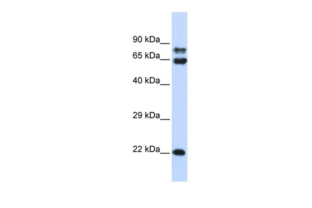 Antibody used in WB on Human 293T at 0.2-1 ug/ml.