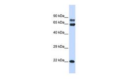 Antibody used in WB on Human 293T at 0.2-1 ug/ml.