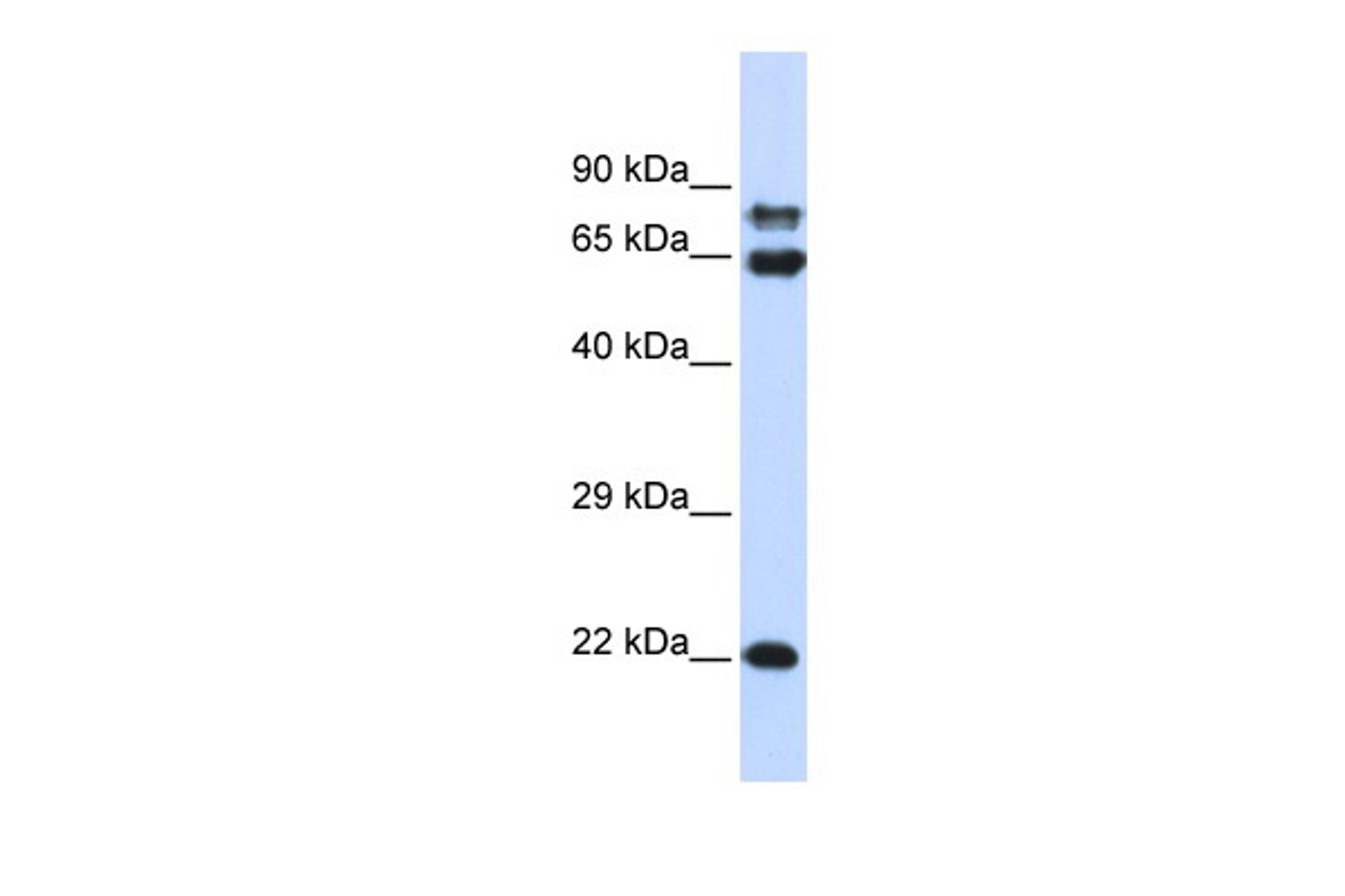 Antibody used in WB on Human 293T at 0.2-1 ug/ml.