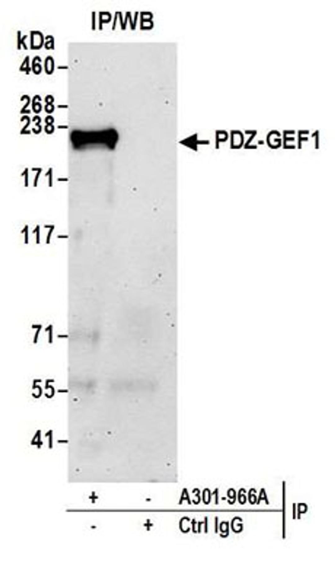 Detection of human PDZ-GEF1 by western blot of immunoprecipitates.