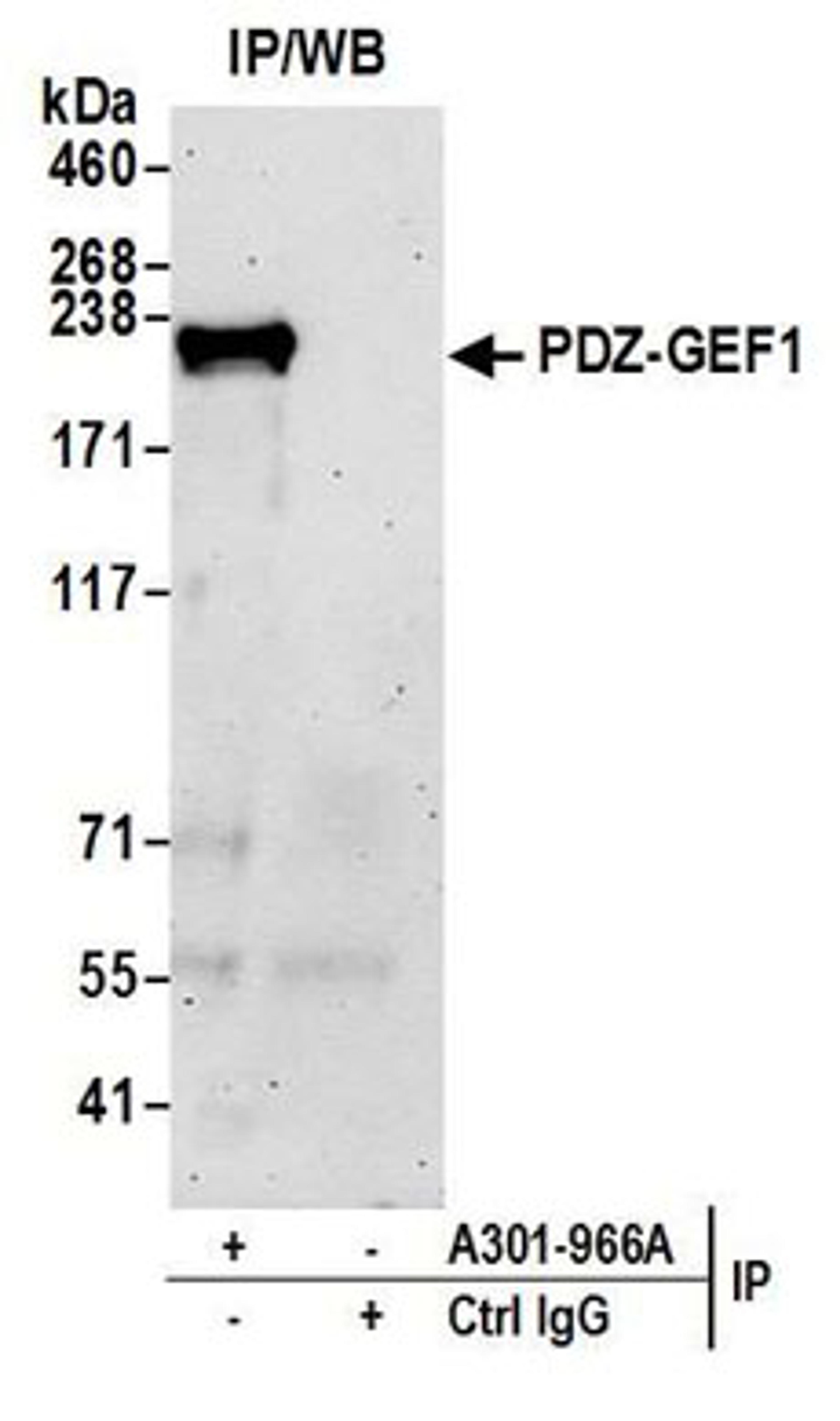 Detection of human PDZ-GEF1 by western blot of immunoprecipitates.