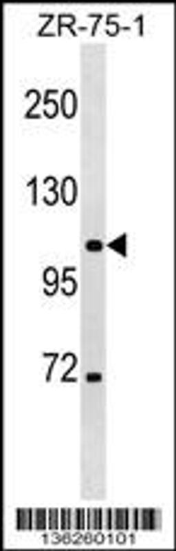 Western blot analysis in ZR-75-1 cell line lysates (35ug/lane).