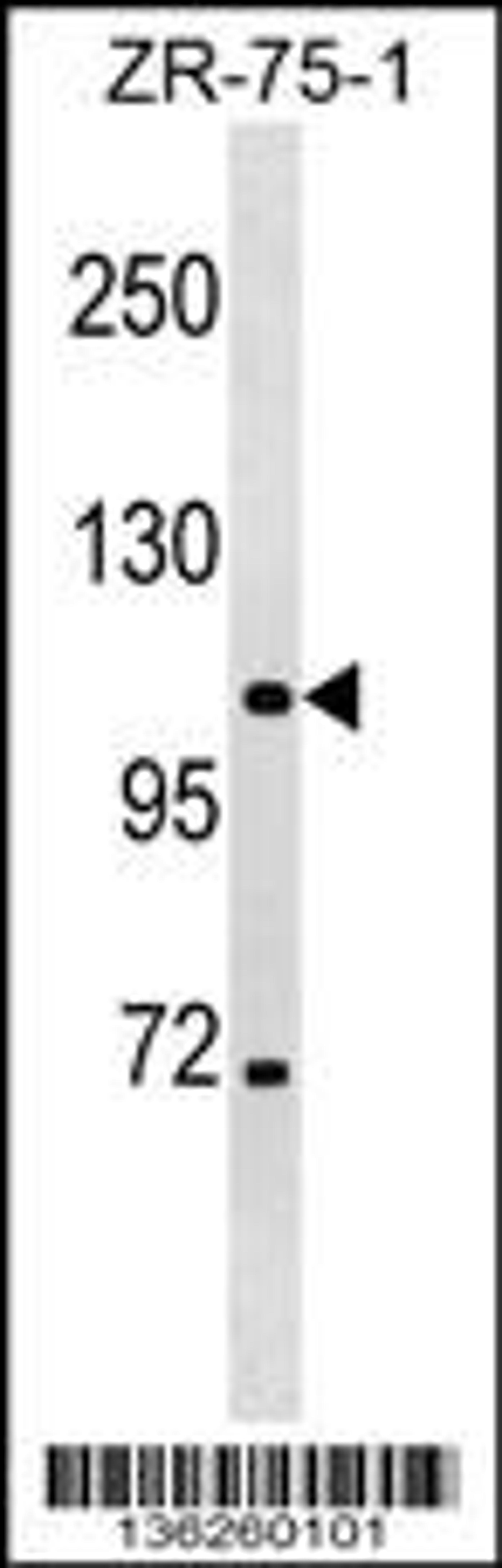 Western blot analysis in ZR-75-1 cell line lysates (35ug/lane).