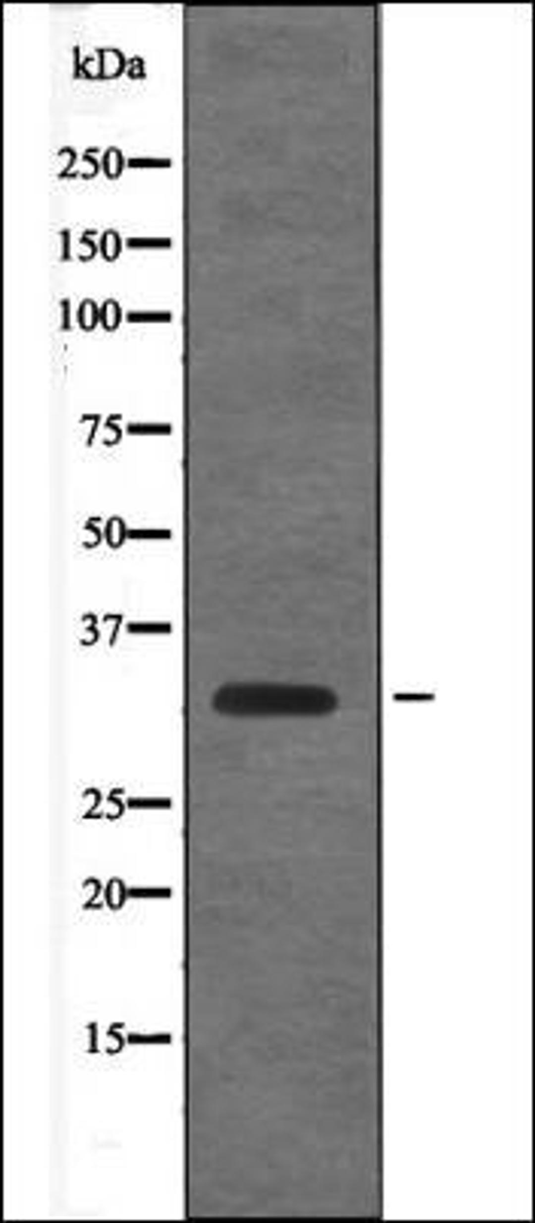 Western blot analysis of EGF treated RAW264.7 whole cell lysates using Cyclin D1 -Phospho-Thr288- antibody