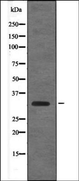 Western blot analysis of EGF treated RAW264.7 whole cell lysates using Cyclin D1 -Phospho-Thr288- antibody