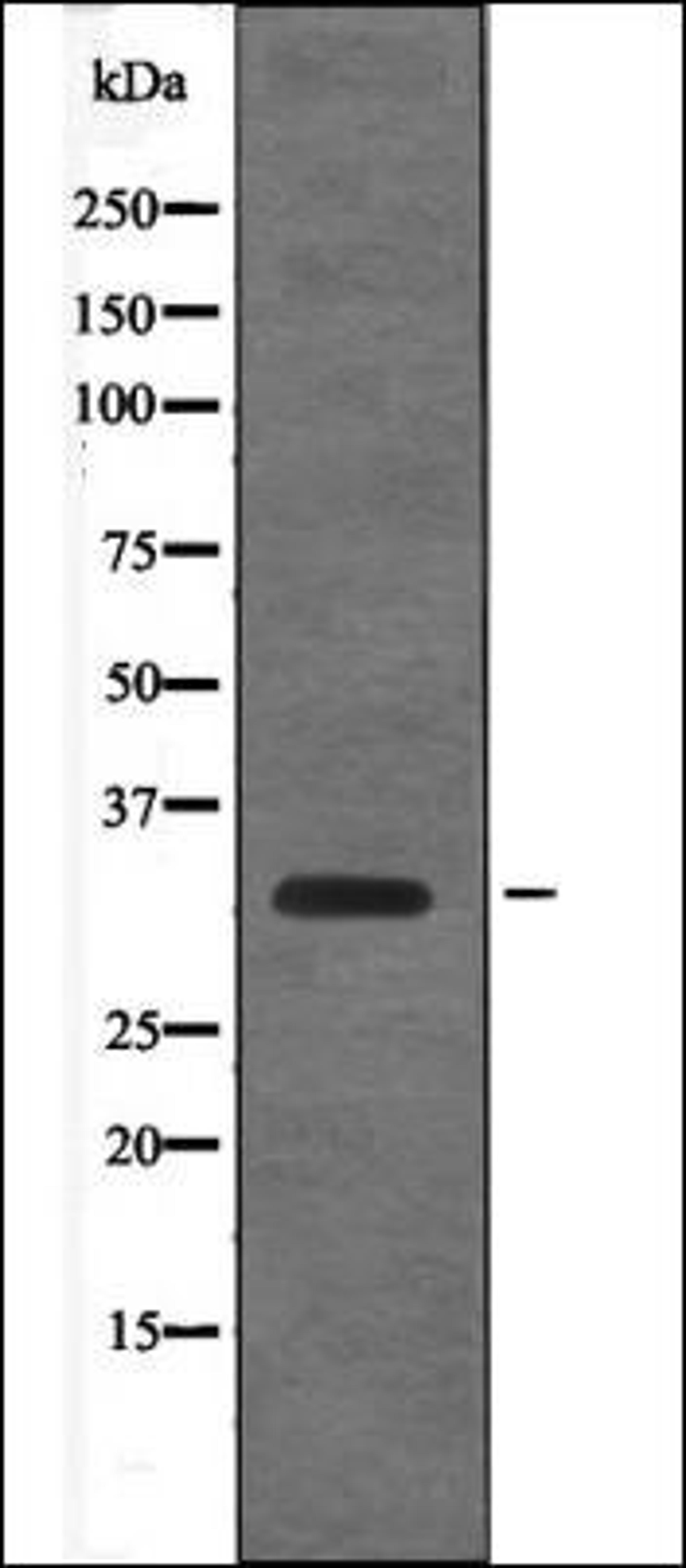 Western blot analysis of EGF treated RAW264.7 whole cell lysates using Cyclin D1 -Phospho-Thr288- antibody