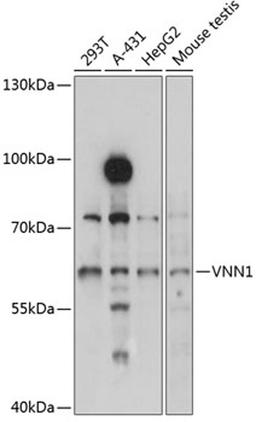 Western blot - VNN1 antibody (A3347)