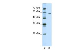 Antibody used in WB on Human Jurkat 1.25 ug/ml.