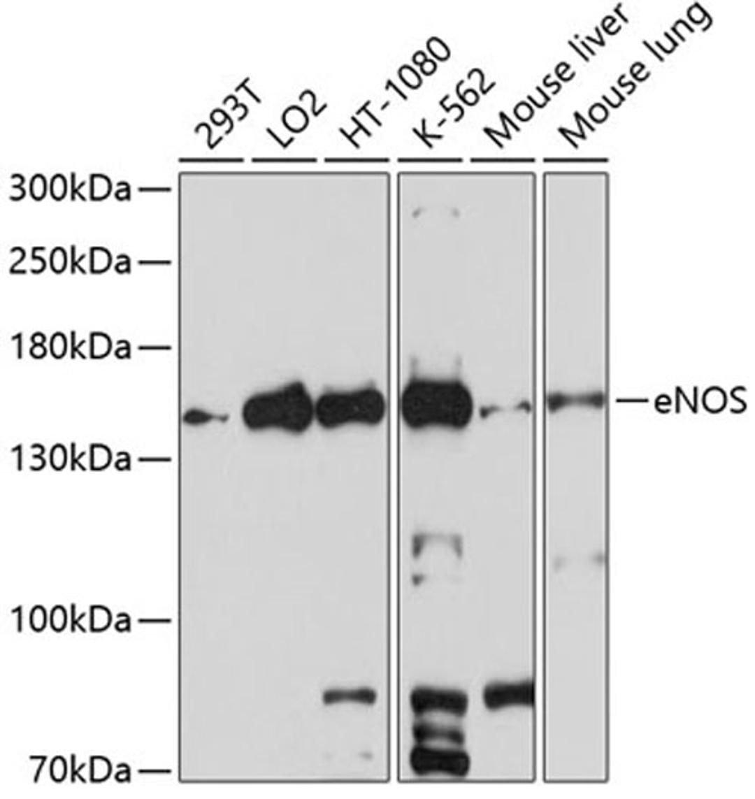 Western blot - eNOS antibody (A1548)