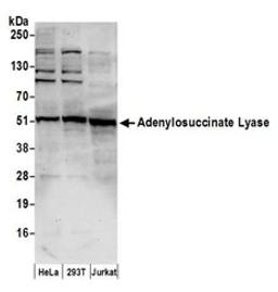 Detection of human Adenylosuccinate Lyase/ADSL by western blot.