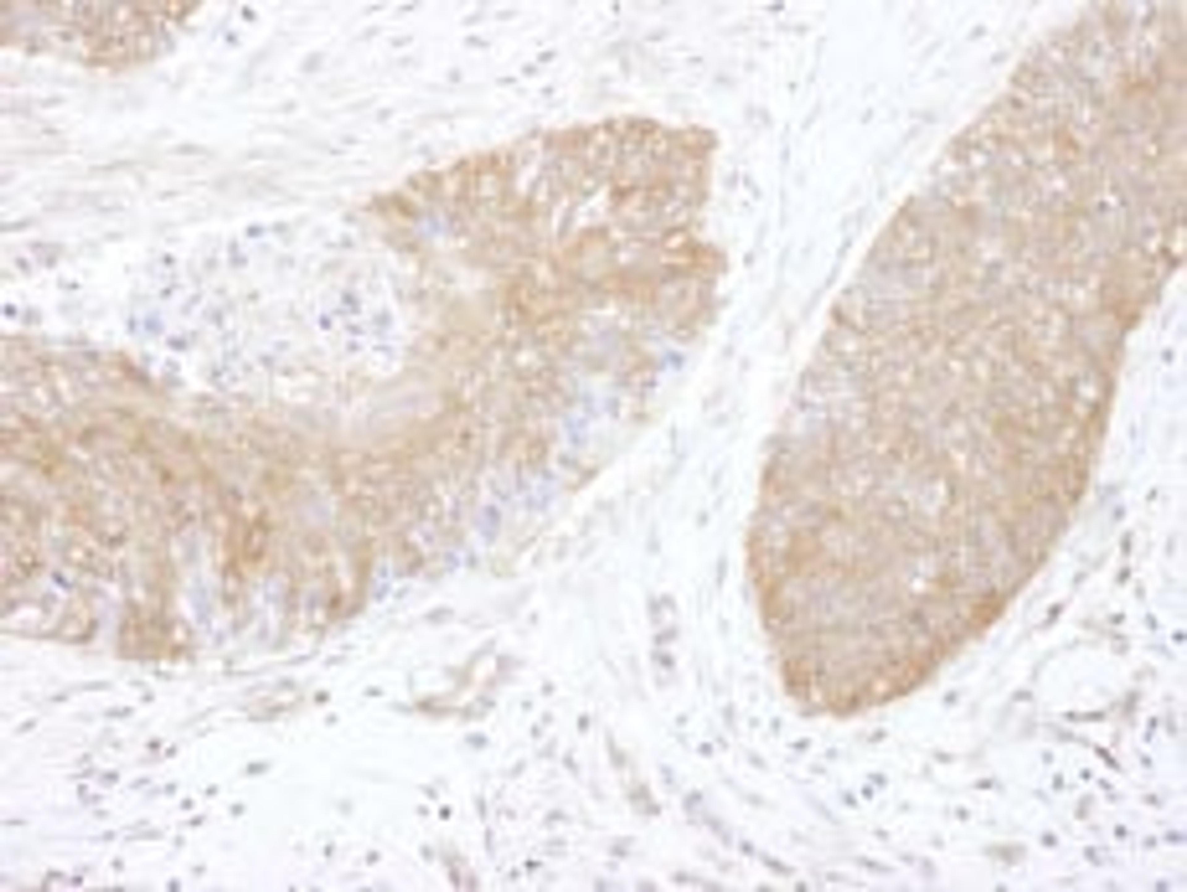 Detection of human CCT5 by immunohistochemistry.