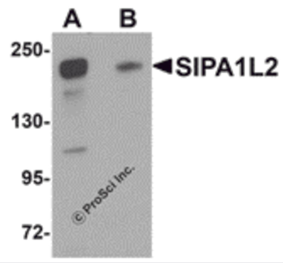 Western blot analysis of SIPA1L2 in rat brain tissue lysate with SIPA1L2 antibody at 1 μg/mL in (A) the absence and (B) the presence of blocking peptide.