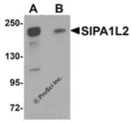 Western blot analysis of SIPA1L2 in rat brain tissue lysate with SIPA1L2 antibody at 1 μg/mL in (A) the absence and (B) the presence of blocking peptide.