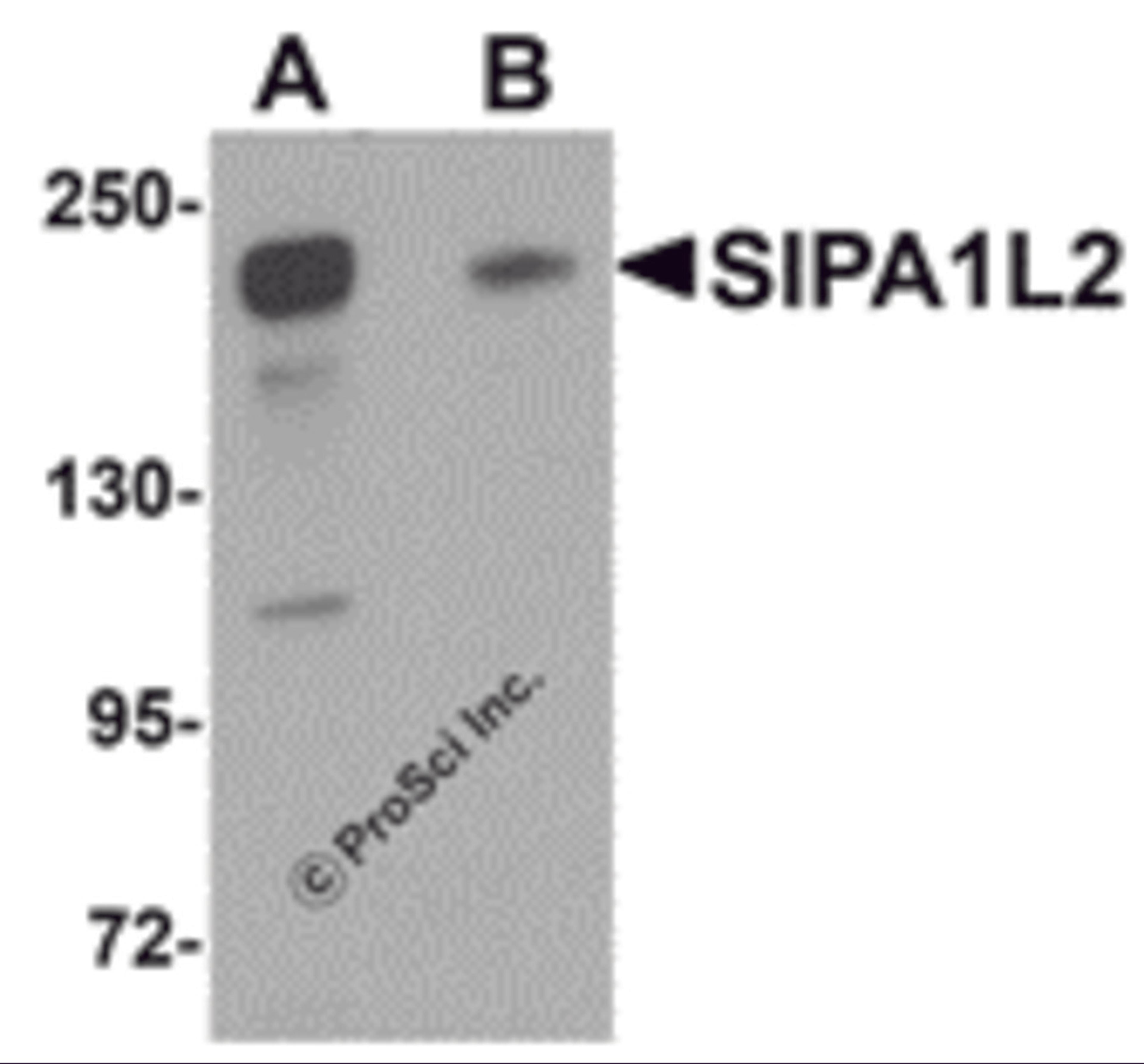 Western blot analysis of SIPA1L2 in rat brain tissue lysate with SIPA1L2 antibody at 1 μg/mL in (A) the absence and (B) the presence of blocking peptide.