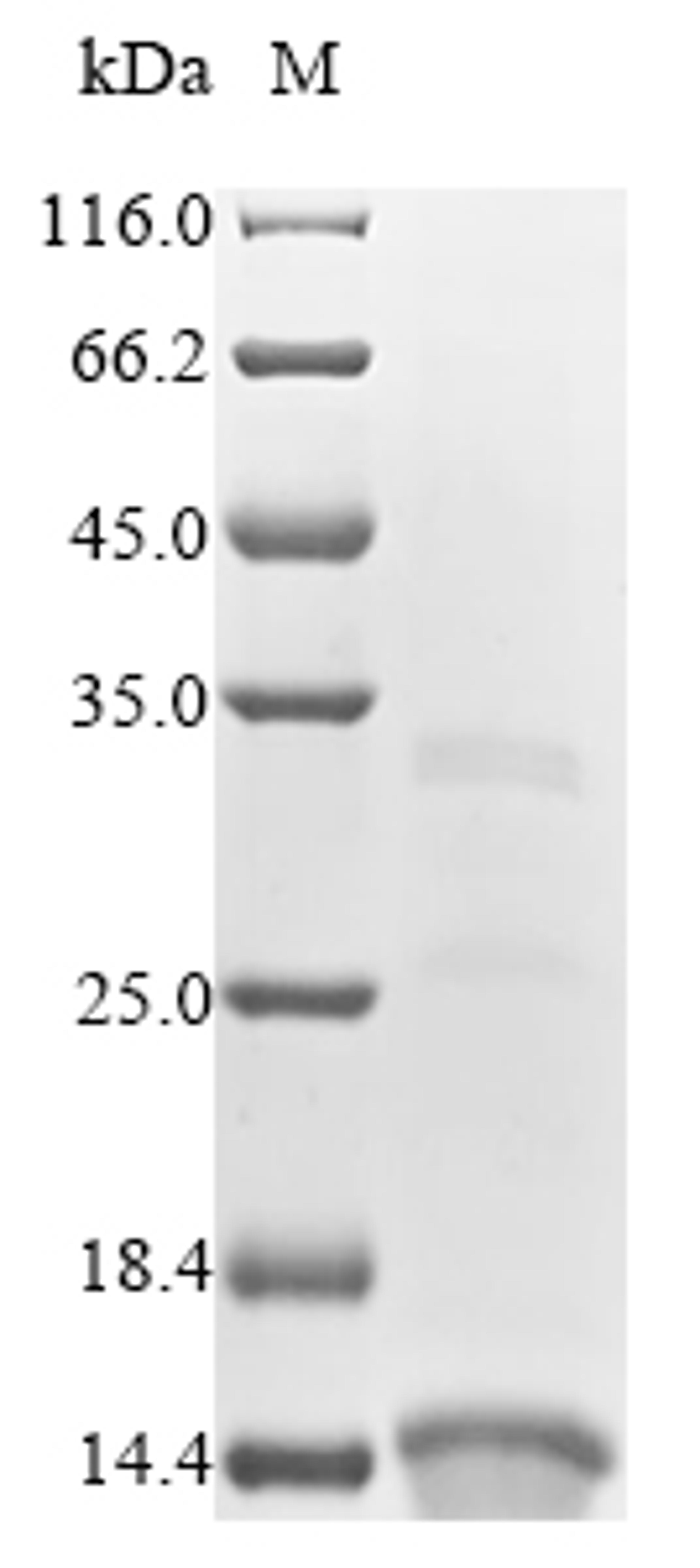 (Tris-Glycine gel) Discontinuous SDS-PAGE (reduced) with 5% enrichment gel and 15% separation gel.